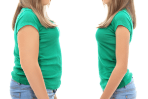 gastric sleeve procedures