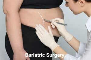 bariatric surgery